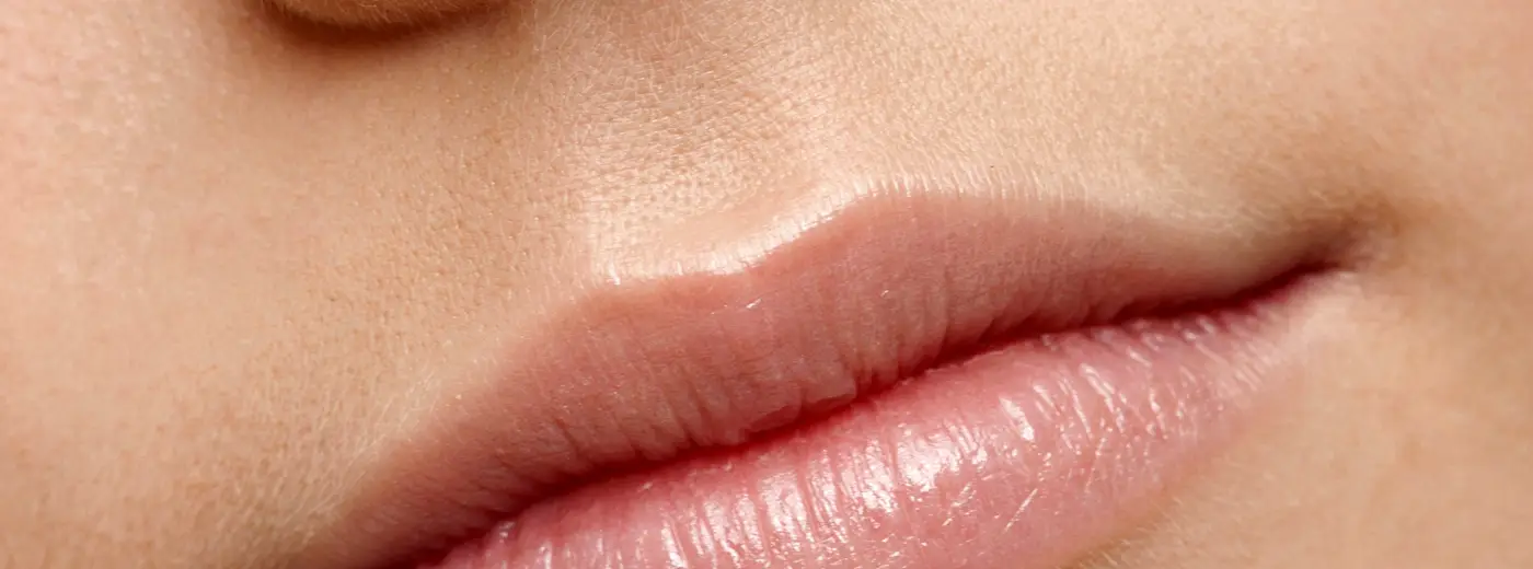 Fillerbehandling av lepper