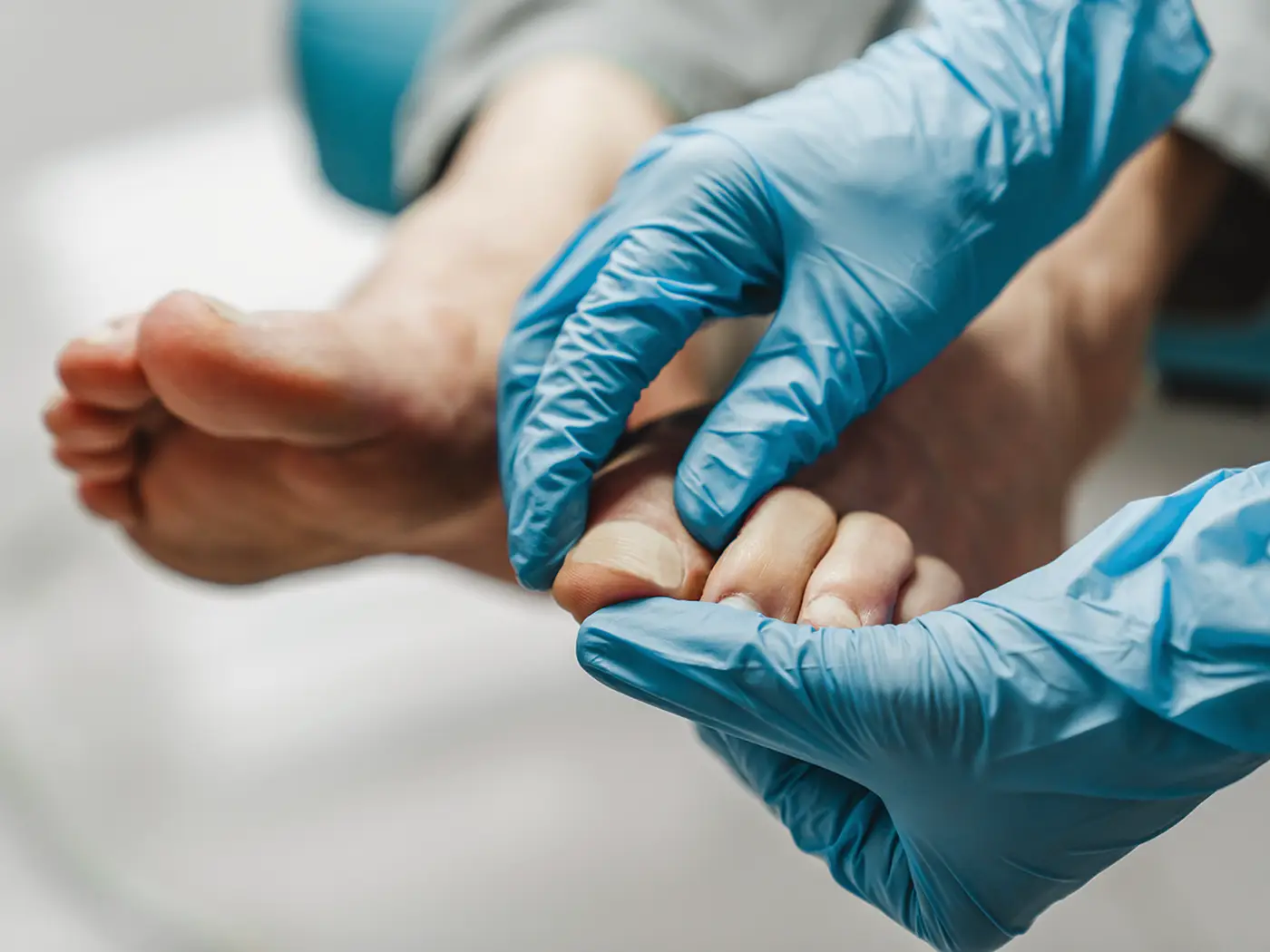 Hallux rigidus behandling Fornebuklinikken spesialist ortopedi