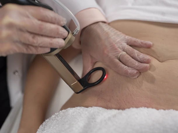 Laserbehandling av arr etter kirurgi